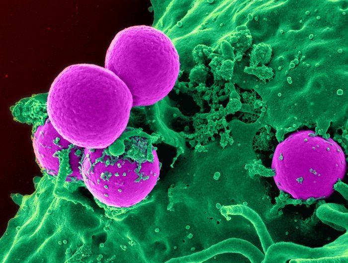 Bacterias en lentes de contacto mal cuidados